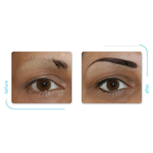 Permanent Cosmetic Makeup (Nouveau Contour)